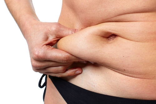 abdominoplasty body contouring