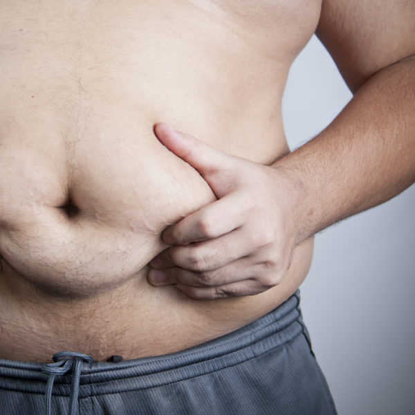 male liposuction